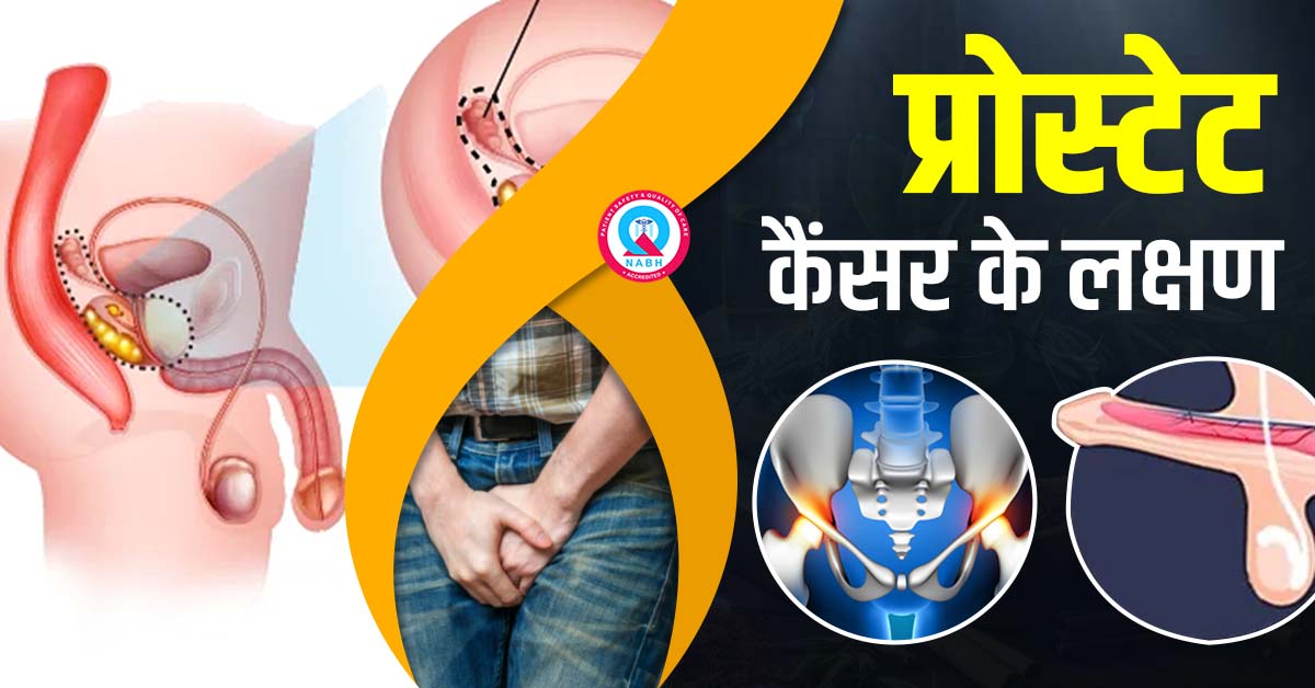 प्रोस्टेट-कैंसर-के-लक्षण